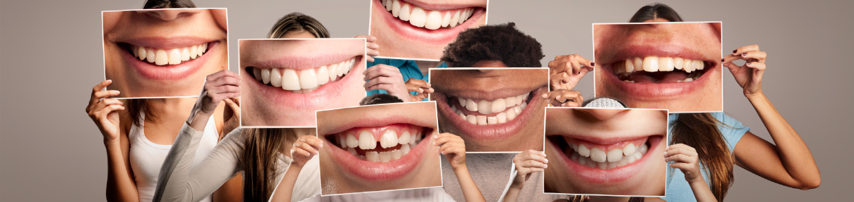 Mehrere Personen halten große Fotos von lächelnden Mündern vor sich, sodass die Bilder der Münder das eigentliche Gesicht verdecken; die Aufnahmen zeigen unterschiedliche Zähne und Lächeln in einer gruppenartigen Anordnung vor neutralem Hintergrund.